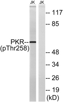 PKR (phospho Thr258) rabbit pAb