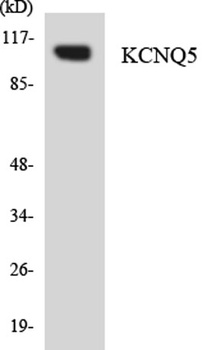 KCNQ5 rabbit pAb Antibody