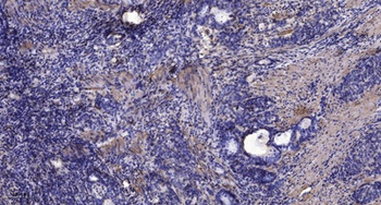 KCNQ5 rabbit pAb Antibody