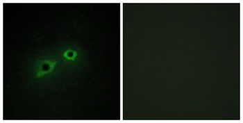 Enterokinase HC rabbit pAb Antibody