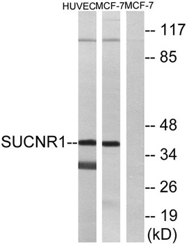 GPR91 rabbit pAb Antibody