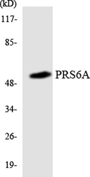 PSMC3 rabbit pAb Antibody