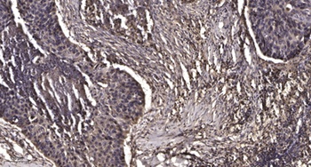 MRP-L47 rabbit pAb Antibody