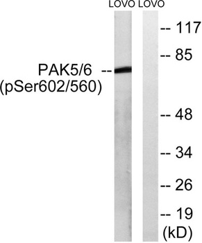 PAK5/6 (phospho Ser602/S560) rabbit pAb Antibody
