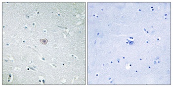EP3 rabbit pAb Antibody