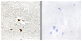 ZNF287 rabbit pAb Antibody