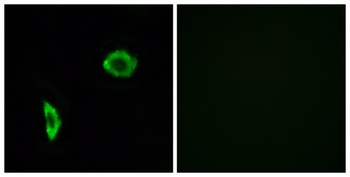 IP Receptor rabbit pAb Antibody