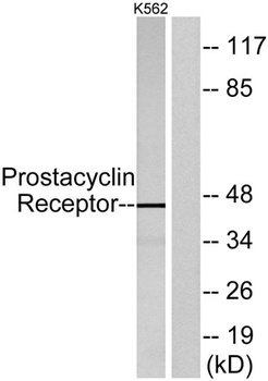 IP Receptor rabbit pAb Antibody