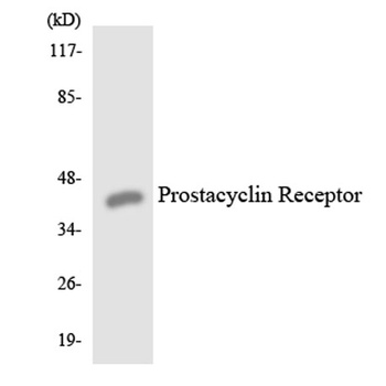IP Receptor rabbit pAb Antibody