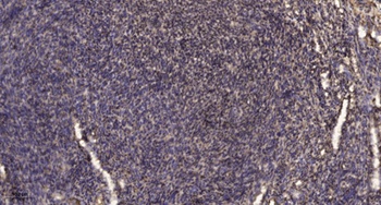 IP Receptor rabbit pAb Antibody