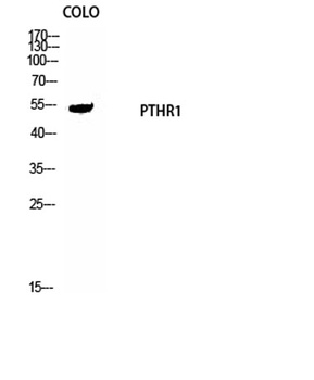 PTH/PTHrP-R rabbit pAb Antibody
