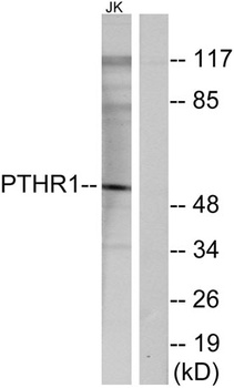 PTH/PTHrP-R rabbit pAb Antibody