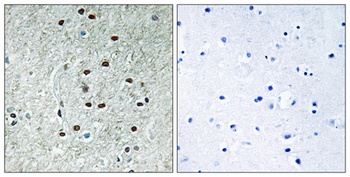 REXO1 rabbit pAb Antibody