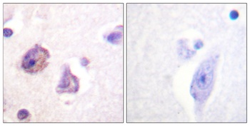 FAK (phospho Tyr576) rabbit pAb