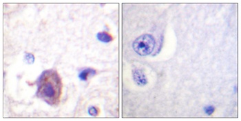 FAK (phospho Ser910) rabbit pAb Antibody