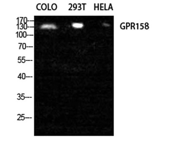 GPR158 rabbit pAb Antibody