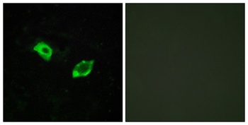 GPR158 rabbit pAb Antibody
