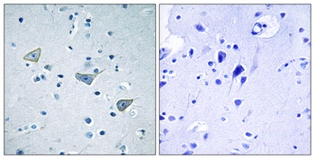 GPR158 rabbit pAb Antibody