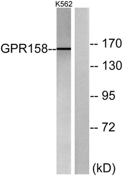 GPR158 rabbit pAb Antibody