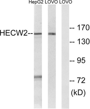 NEDL2 rabbit pAb Antibody