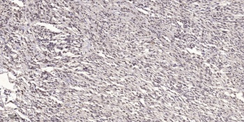 ARRDC3 rabbit pAb Antibody