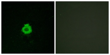 BAI-2 rabbit pAb Antibody
