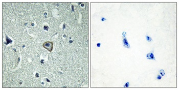 BAI-2 rabbit pAb Antibody