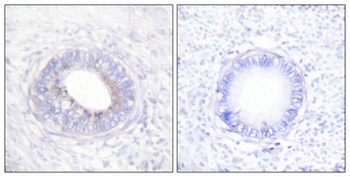 SH-PTP1 rabbit pAb Antibody