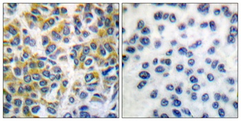SH-PTP1 rabbit pAb Antibody