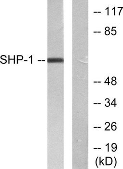 SH-PTP1 rabbit pAb Antibody