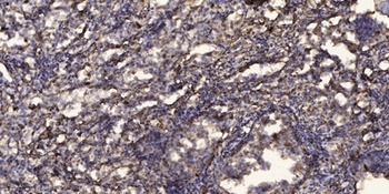 Peroxin 5 rabbit pAb Antibody