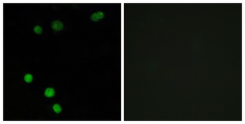 TP53INP2 rabbit pAb Antibody