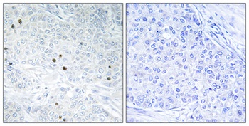 TP53INP2 rabbit pAb Antibody
