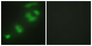 Zhangfei rabbit pAb Antibody