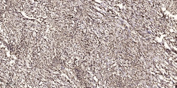 Rad51 (phospho Thr309) rabbit pAb Antibody