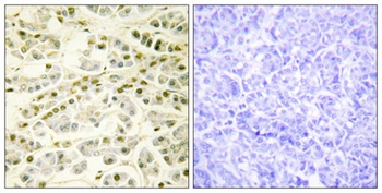 Rad51B rabbit pAb Antibody