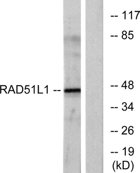 Rad51B rabbit pAb Antibody