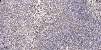 Recoverin rabbit pAb