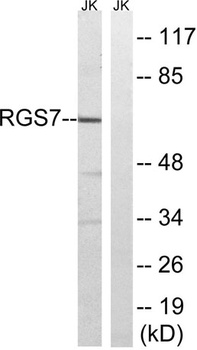 RGS7 rabbit pAb Antibody
