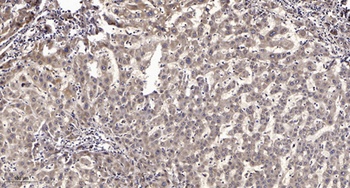 RGS12 rabbit pAb Antibody