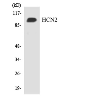 HCN2 rabbit pAb Antibody