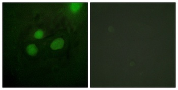 RPA32 rabbit pAb Antibody