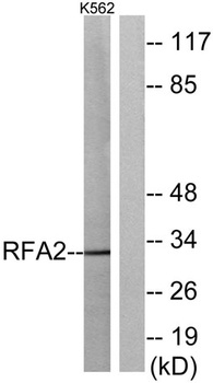 RPA32 rabbit pAb Antibody
