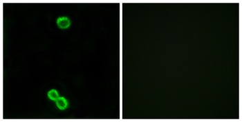 Ribosomal Protein L3L rabbit pAb Antibody