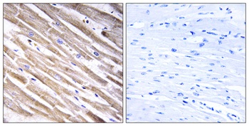 Ribosomal Protein L3L rabbit pAb Antibody