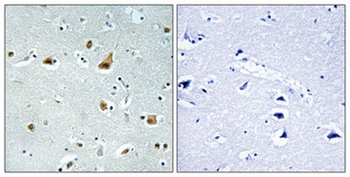 Ribosomal Protein L5 rabbit pAb Antibody