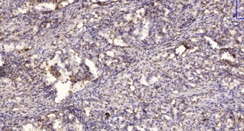 Ribosomal Protein L11 rabbit pAb Antibody