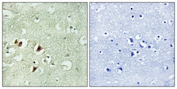 Ribosomal Protein L15 rabbit pAb Antibody