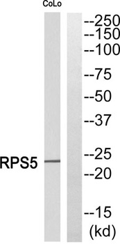 Ribosomal Protein S5 rabbit pAb Antibody