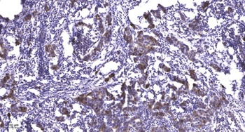 Ribosomal Protein S5 rabbit pAb Antibody